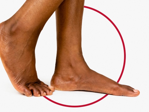 Imagem ampliada do pé de um homem com unhas lindas e saudáveis após o tratamento Canesten